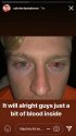 Calvin Vlaanderen.jpg